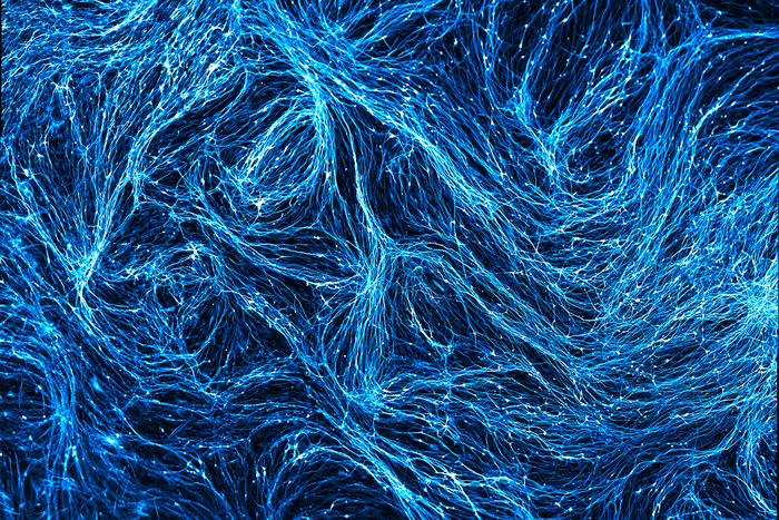 How microglia contribute to Alzheimers disease