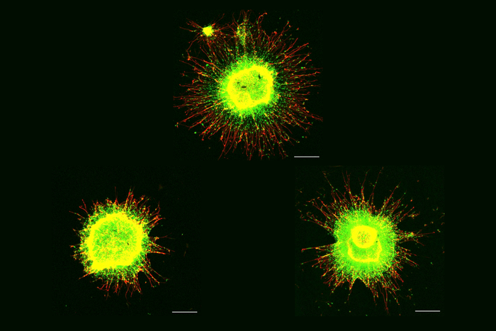 Neural progenitor cell migration