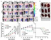Nf-Trip Suppresses Tumor Growth of HCC Orthotopic Model