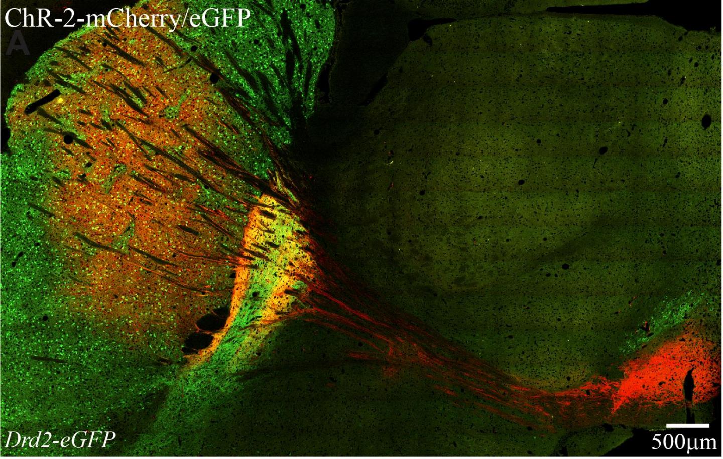 Panoramic View of a Mouse Brain Including the Neostriatum