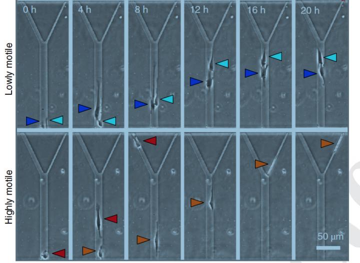 Most Mobile, Aggressive Cancer Cells Travel Farthest