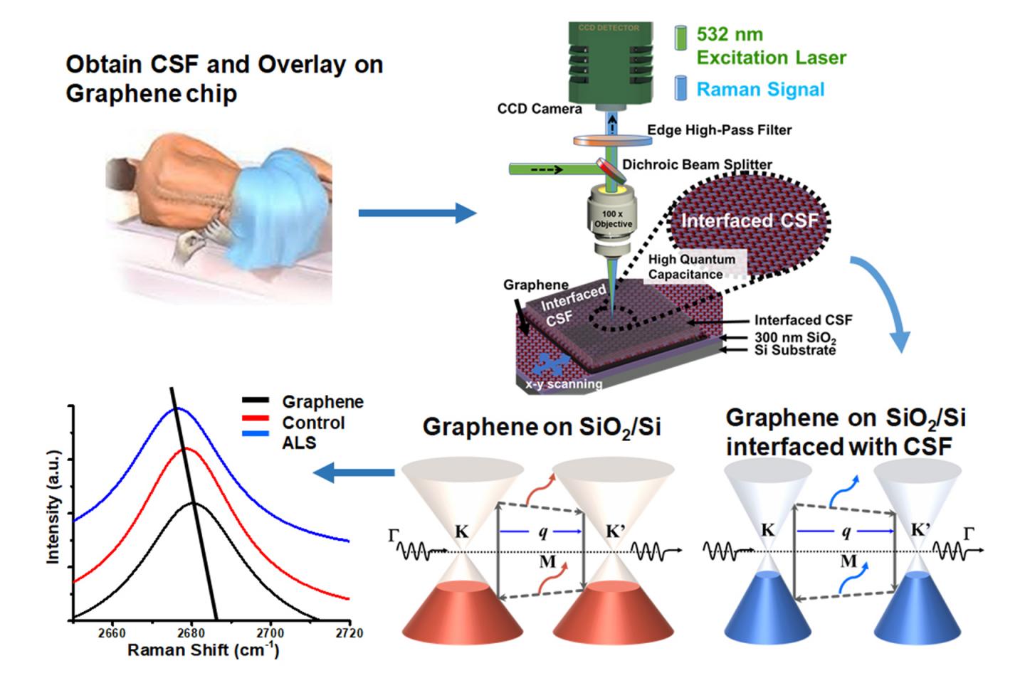 How Graphene Can be used to Detect ALS Biomarkers from Cerebrospinal Fluid