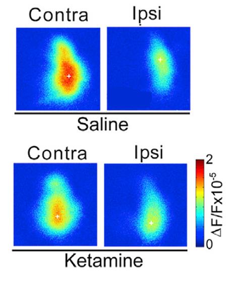 Ketamine Restores Visual Acuity