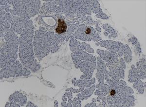 Mouse islet in pancreas