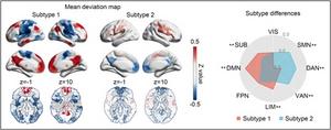 Brain imaging-based biomarker of depression identified