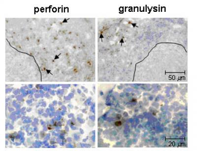 TB Can Evade the Immune Response