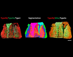 Three consecutive longitudinal sections of mouse GAS-SOL muscle were used for immunofluorescence staining and co-registered MSI