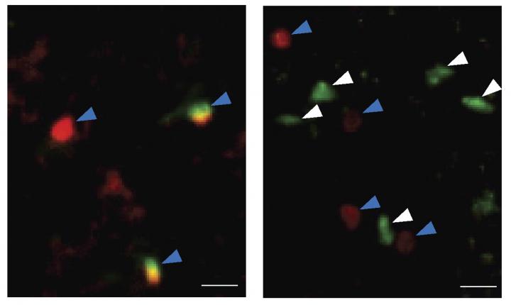 ILC2 Cells Accumulate in the Choroid Plexus with Age