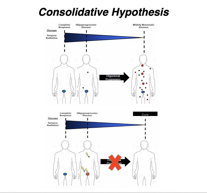 Prostate Cancer Image Eurekalert Science News Releases 3313