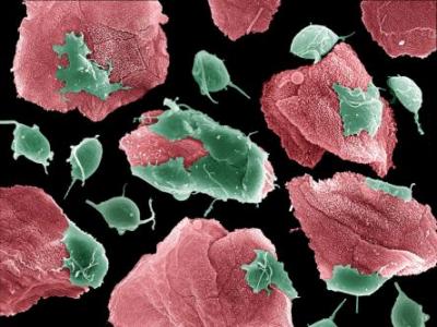 Scientists Crack the Genome of the Parasite Causing Trichomoniasis