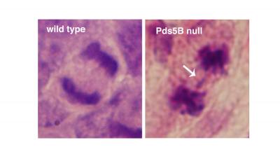Cells Lacking Pds5B Divide Their Genetic Material in a Defective Manner