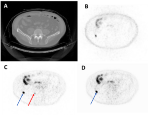 Representative axial image from a test set imaging study.