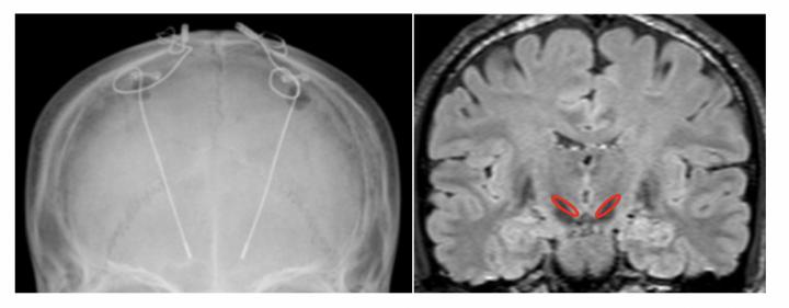 Figure 2: X-ray Image