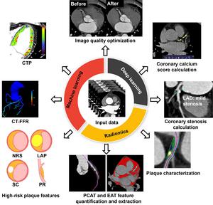 Application of artificial intelligence (AI) in cardiovascular CT