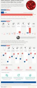 Sickle cell disease—global mortality burden is nearly 11 times higher than recorded