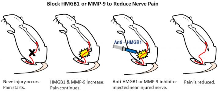 Block HMGB1 or MMP-9 to Reduce Nerve Pain