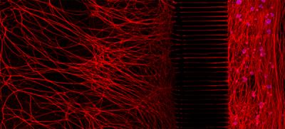 The Secret Lives (and Deaths) of Neurons