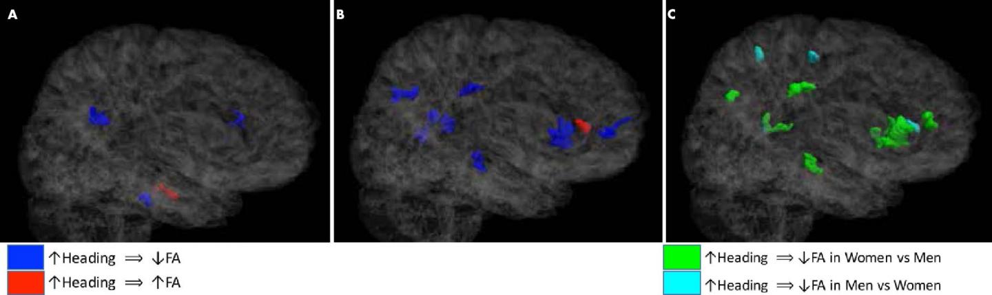 Images of Right Hemisphere in Male and Female Soccer Players