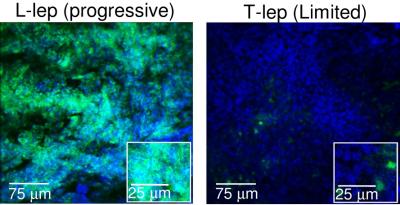 Micro-RNA in Leprosy Skin Specimens