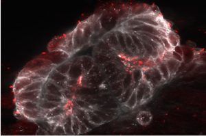Cilia lining surface of human kidney organoid