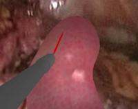 Visible Human Surgical Cutting