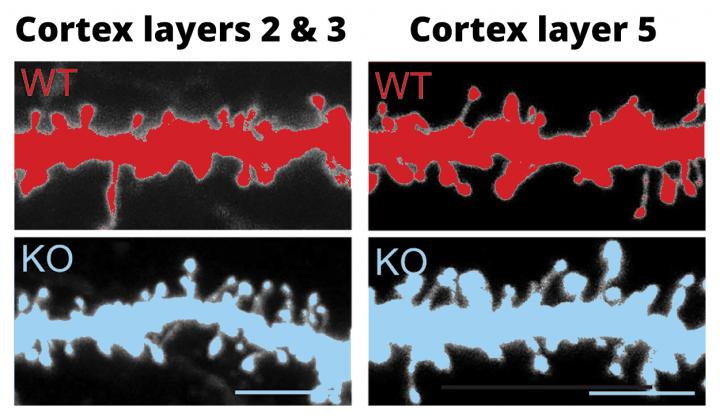 Knockout of FABP4 Changes the Morphology of Cortical Neurons