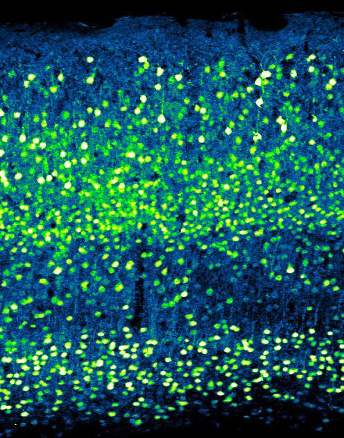 A Single Gene Boosts Brain Plasticity