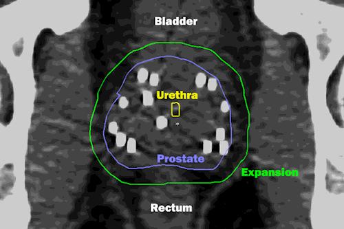 MRI