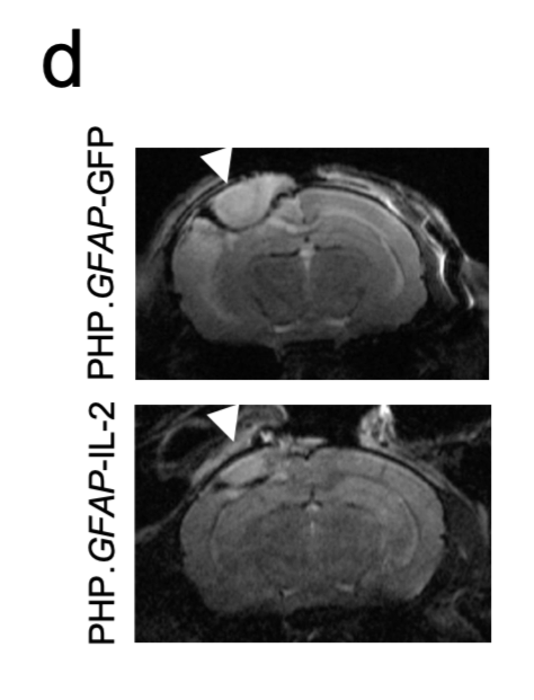 Magnetic resonance imaging (MRI) to assess damage at the injury site