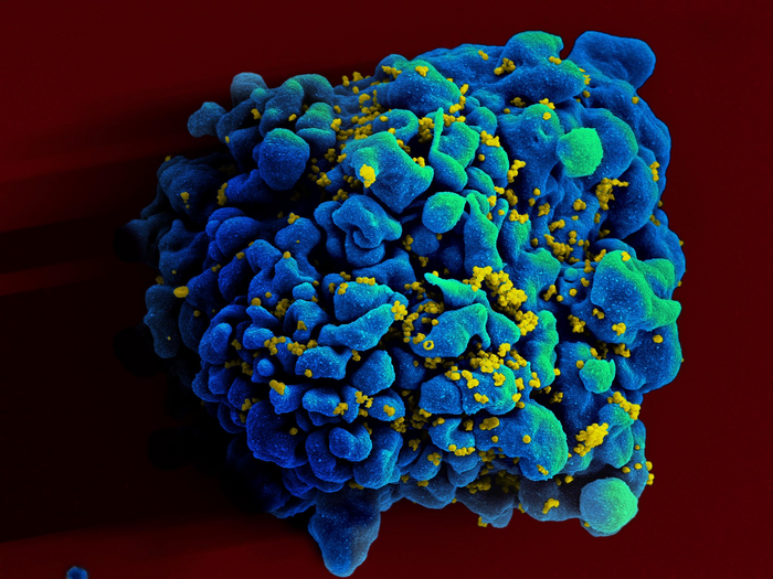 HIV infected H9 t-cell