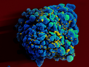 HIV infected H9 t-cell