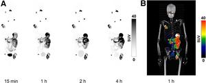 Whole-body maximum-intensity projections over time after [68Ga]Ga-DPI-4452 administration.