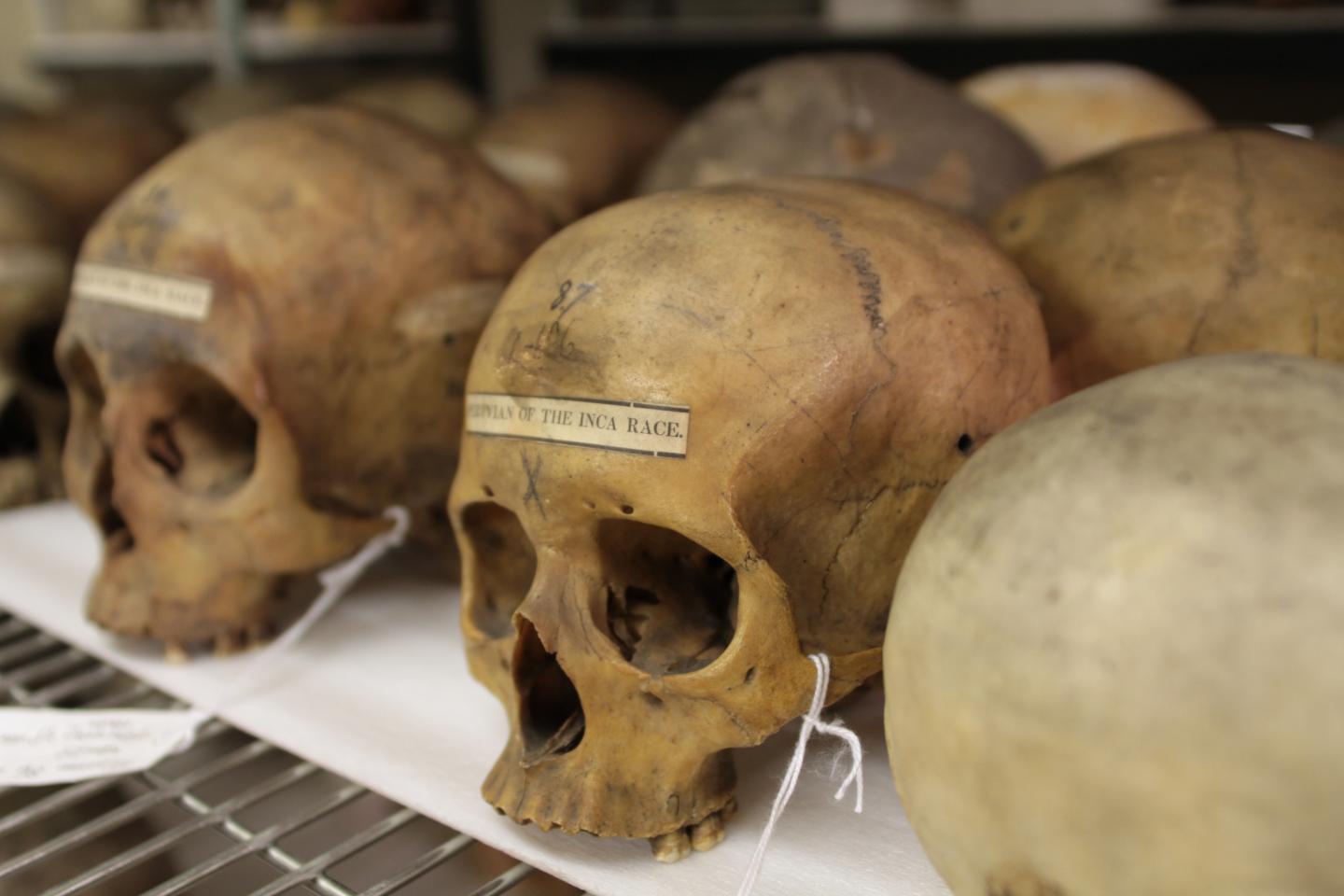 A New Take On The 19th Century Skull Collecti Eurekalert