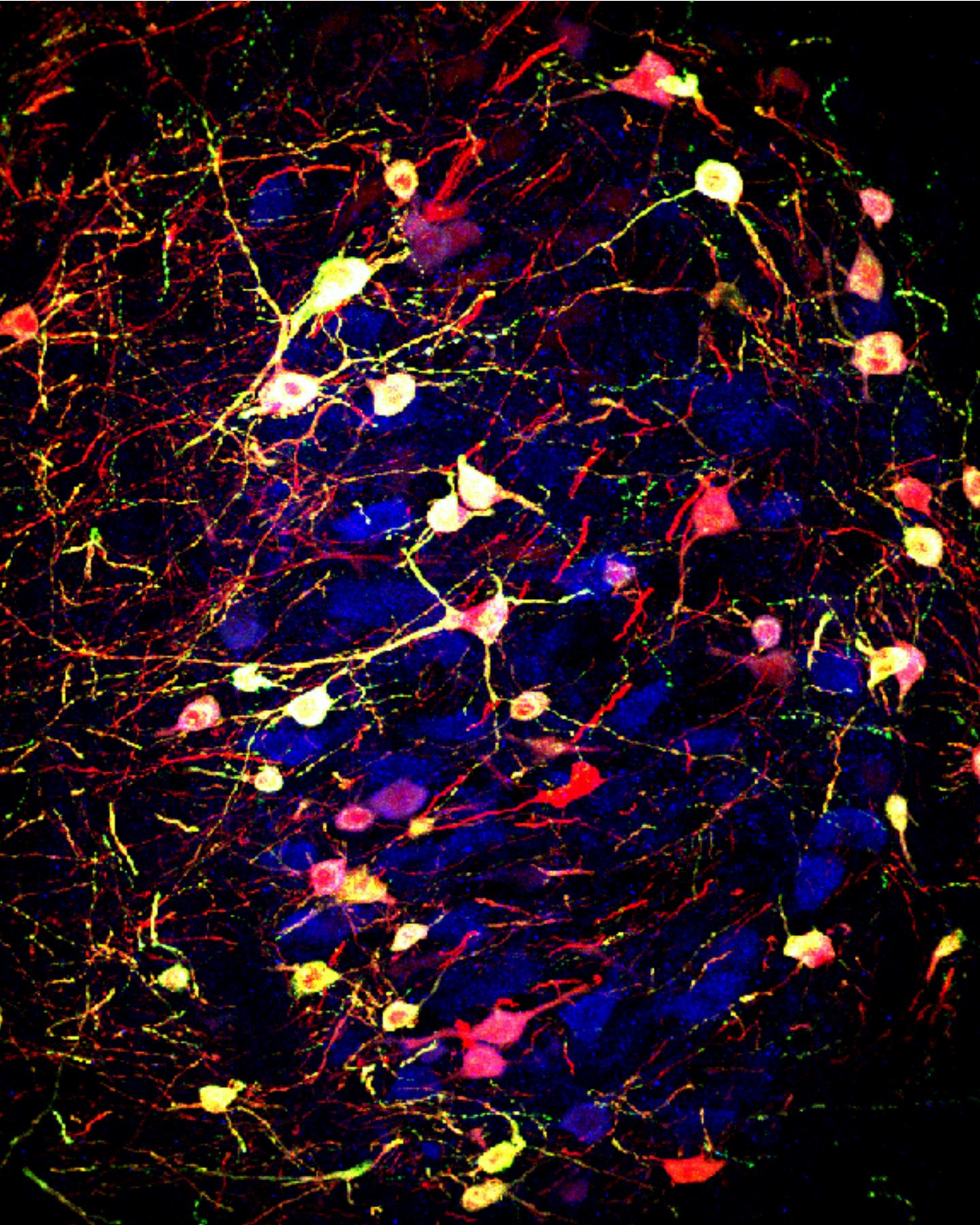 Neurotransmitter change