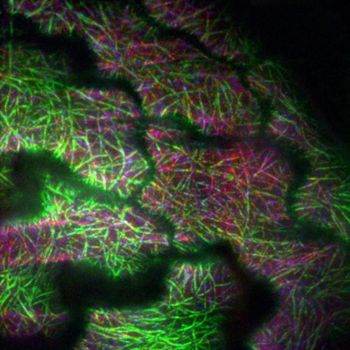 Kinesins and Their Regulator IMB4 in a Growing Plant Cell