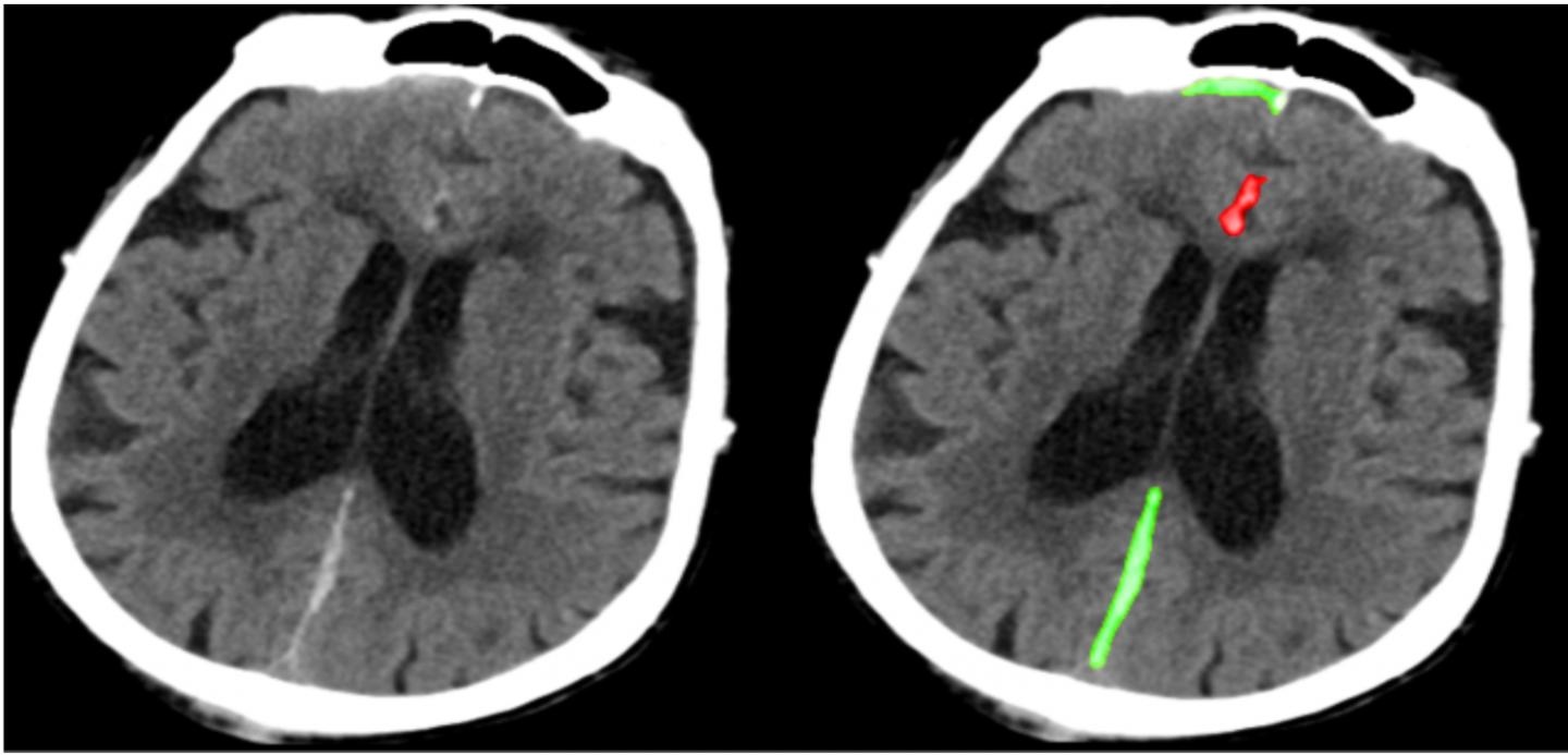 Deep Learning Algorithm