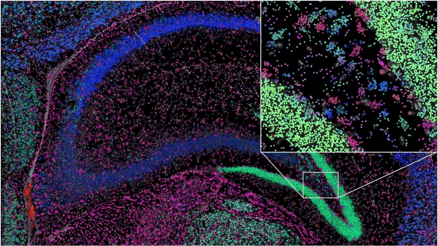 Hippocampus from mouse brain