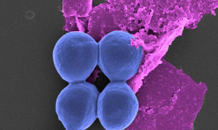 Black phosphorus treatment on bacteria