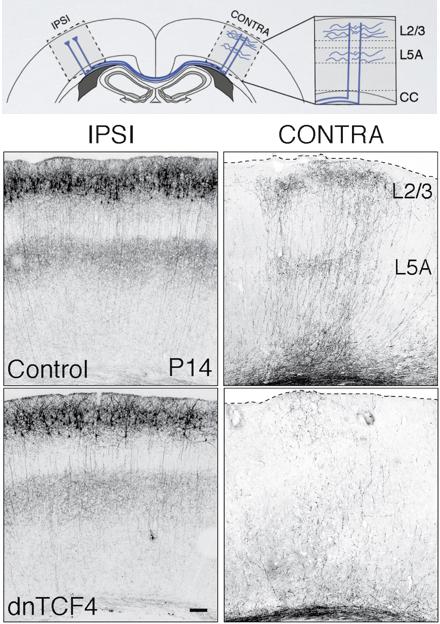 Connectivity Deficit