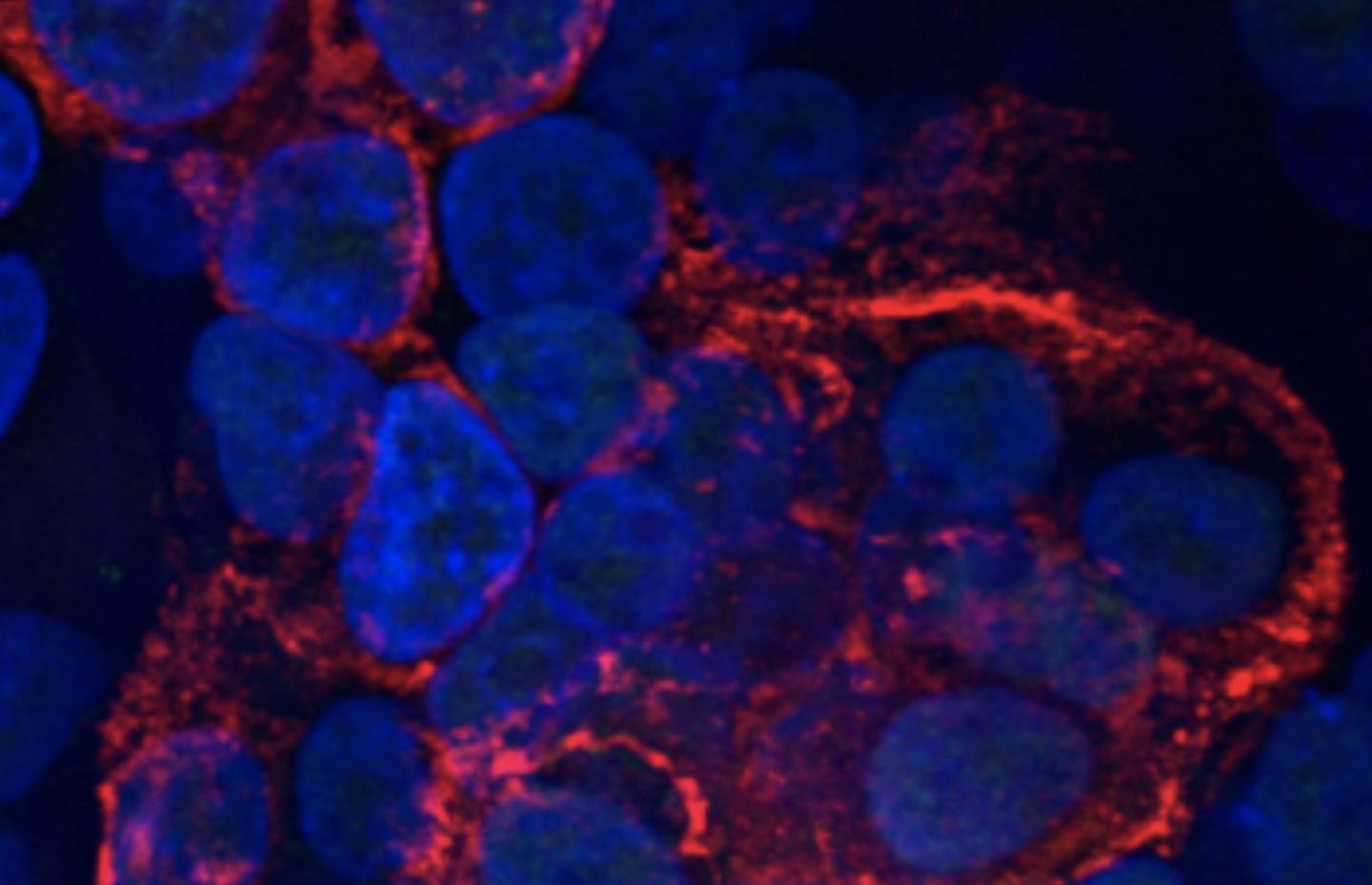 Human lung cells (blue) infected with SARS-CoV-2 (red). Courtesy of Hekman, et al.