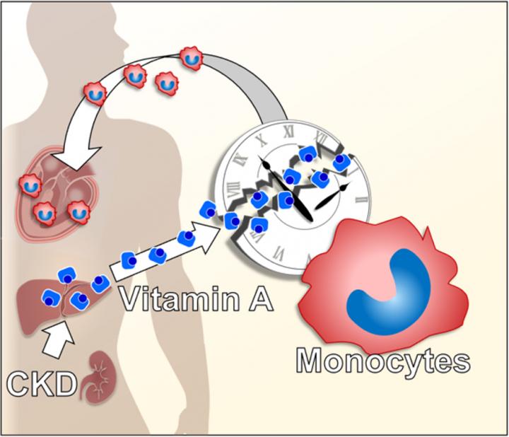 How CKD results in heart inflammation and fibrosis