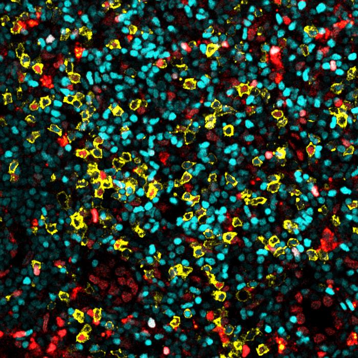 Immune cells in lymph nodes