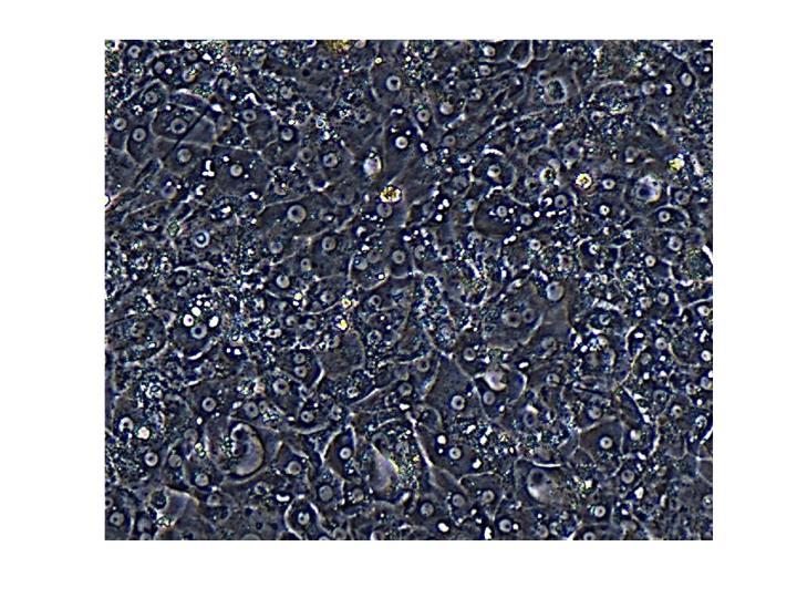 Liver-Like Structures for Studying Hepatitis B Virus Infection