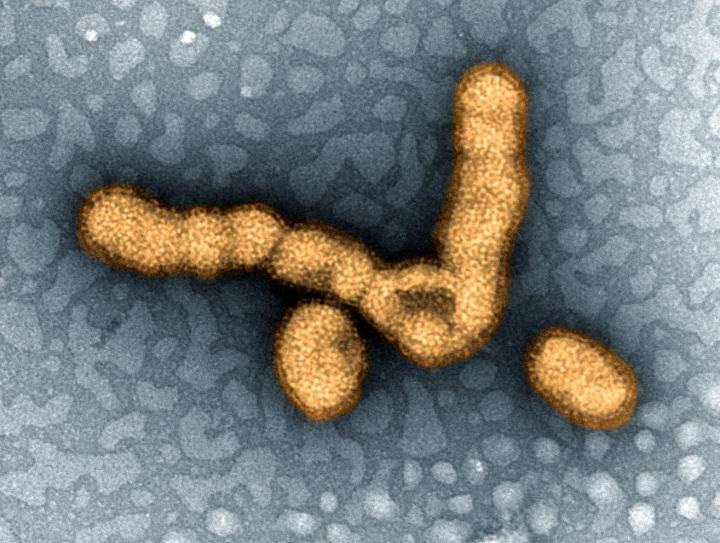 H1N1 Influenza Virus Particles