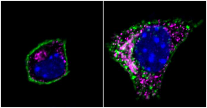 Specific Genetic Variant May Help Prevent Obesity