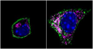 Specific Genetic Variant May Help Prevent Obesity