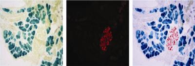 New Direction for Pancreas Cell Regeneration