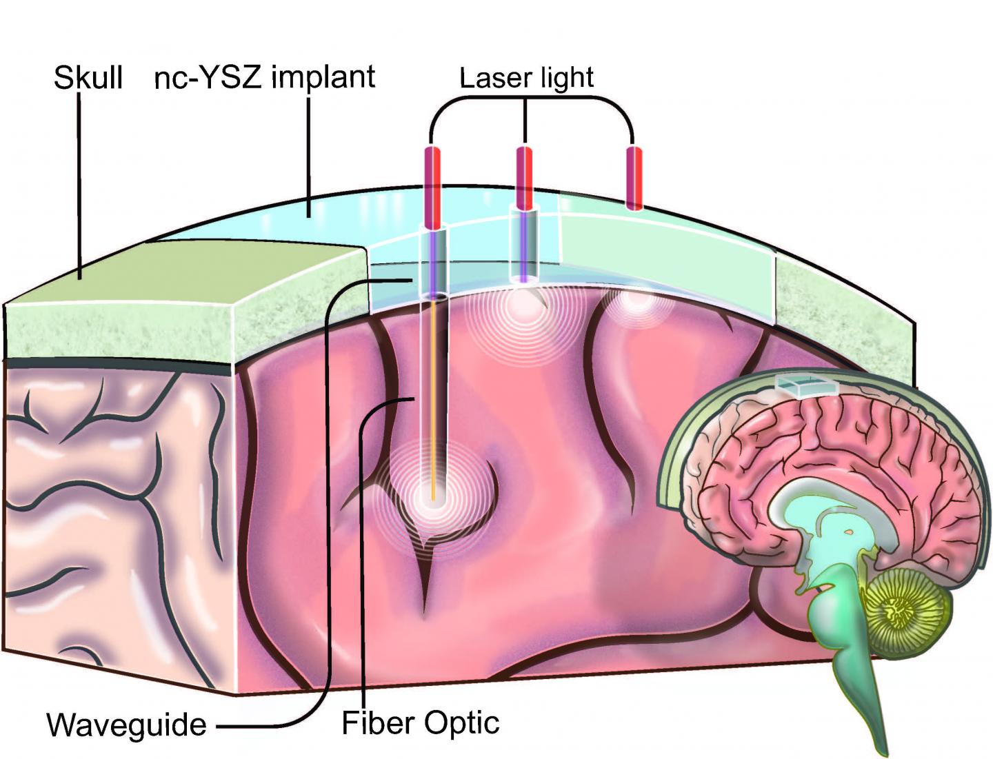 Illustration of the Window to the Brain