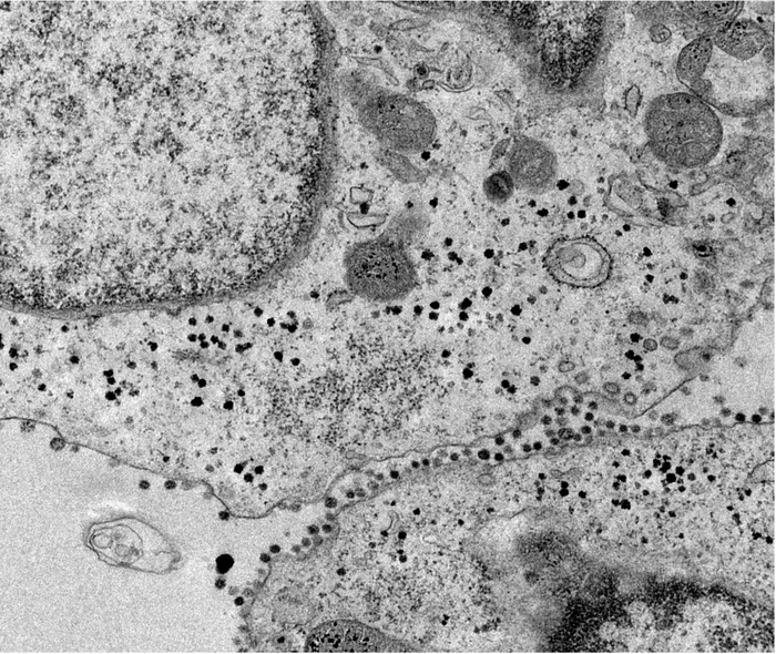 SARS-CoV-2 Infection in Human Kidney Organoids Depends on ACE2