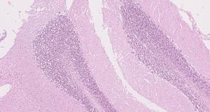 Histological image of cerbellum sample